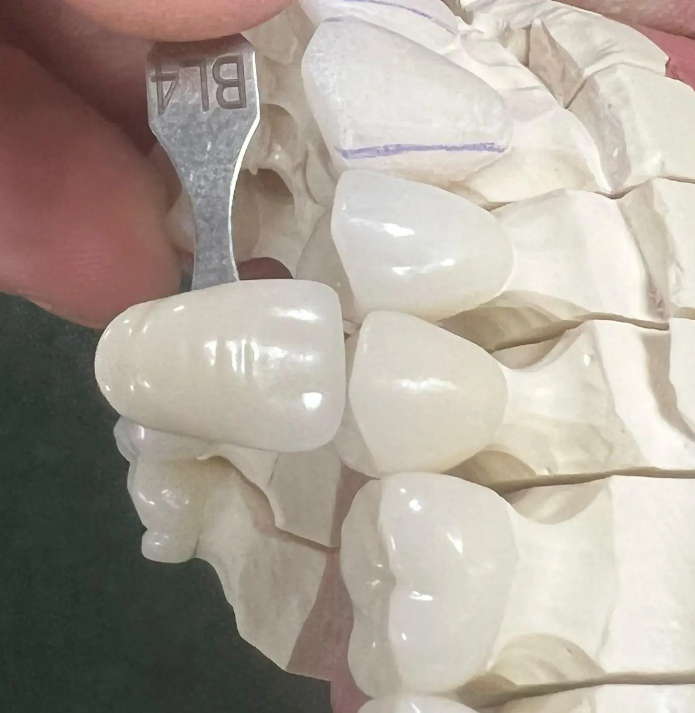 Hot Sale 98mm Dental Consumable Materials Full ceramics Multilayer Zirconia Blanks  4d pro ml