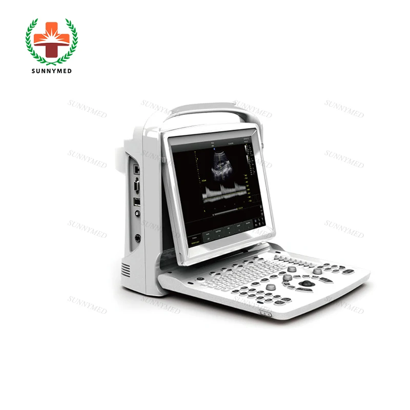  Chison medical Eco1 Eco3 advanced BW портативная ультразвуковая машина с функцией