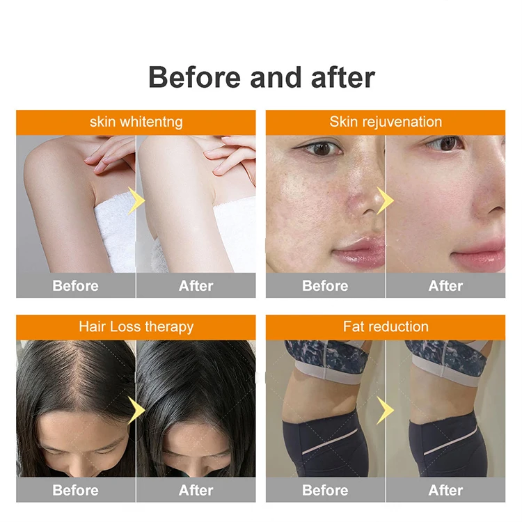 Best Spa Salon 360 Coverage UVA UVB Rays Indoor Capsule Led Collagen Red Light Solarium Sun Red Light Therapy Tanning Bed