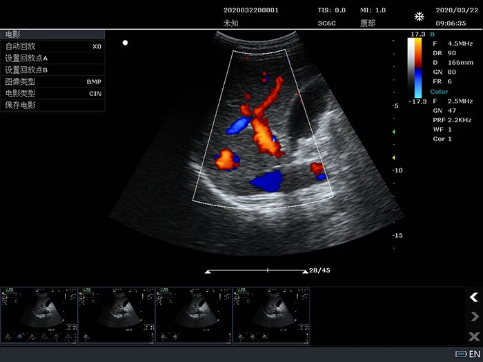 C10B Color Doppler Ultrasound Machine Portable Device