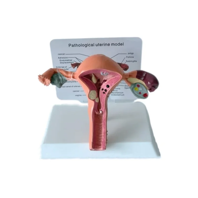 High quality female reproductive phantom model uterine model