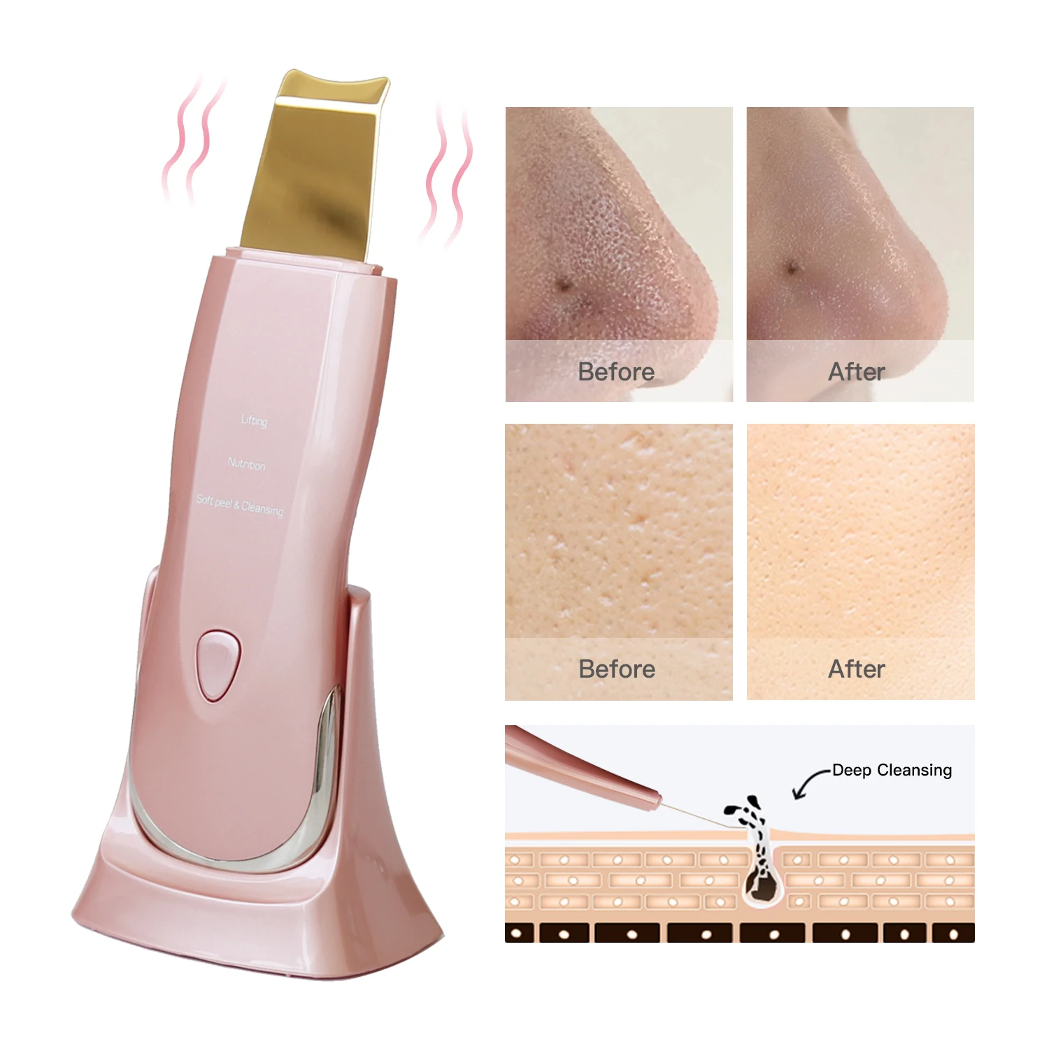 Promotional Price Deep Cleansing Ultrasonic Facial Scraper Skin Scrubber Exfoliators Ultrasonic Face Tools Skin Scrubber