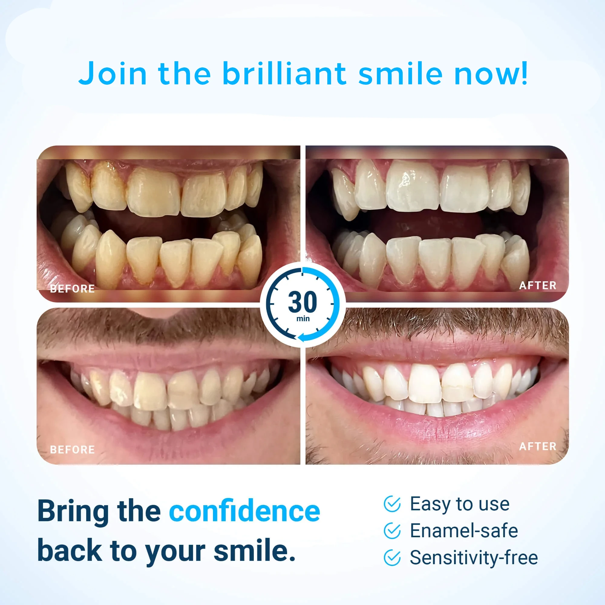 Customize Fast Whiten Tooth 7 Treatment OEM Peroxide Free Fruity Teeth Whitening Strips For Sensitive Teeth