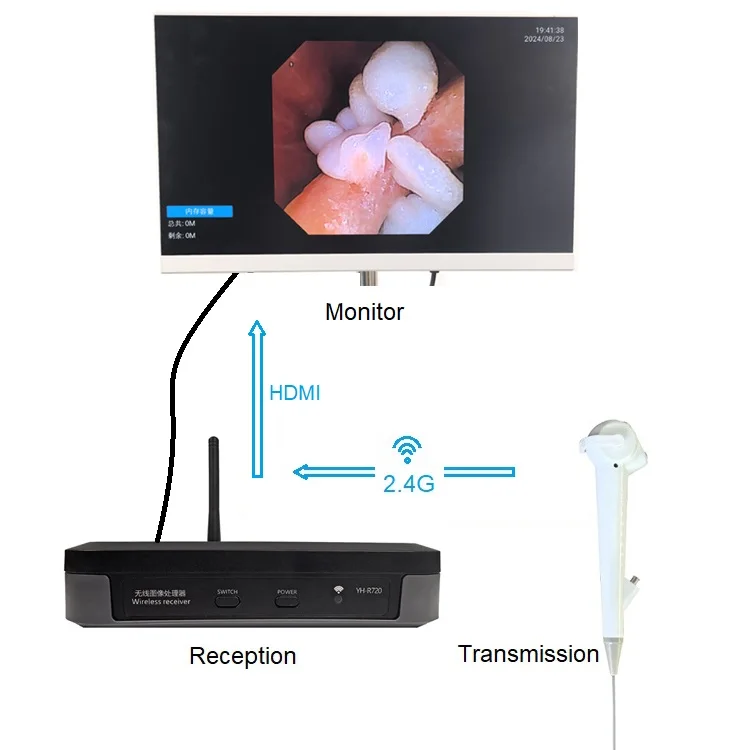 China Wholesale Popular design Wireless Veterinary Endoscope Flexible Gastroscope Digital Portable Endoscope