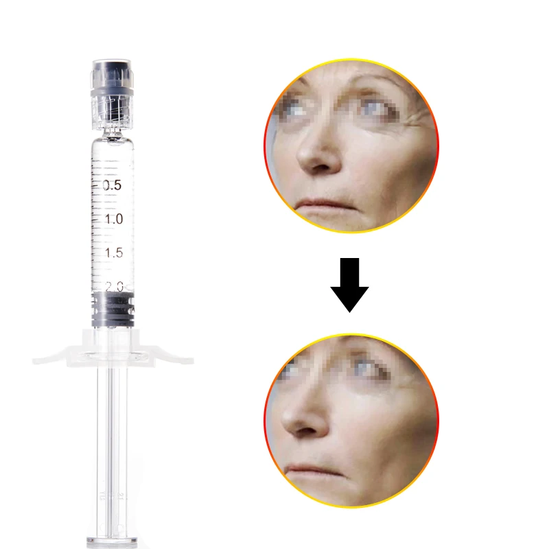 Deenora most popular 2ml injectable cross linked korea neuramis hyaluronic acid dermal fillers for face care penis enlarge