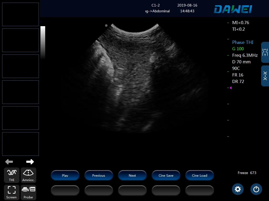 Pc Platform Full Digital Veterinary Black And White Ultrasound Diagnostic System