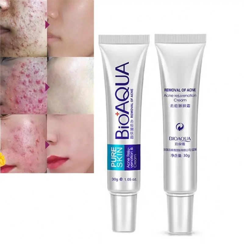 BIOAQUA Moisturizing Face Cream Skin Care Acne Treatment Cream