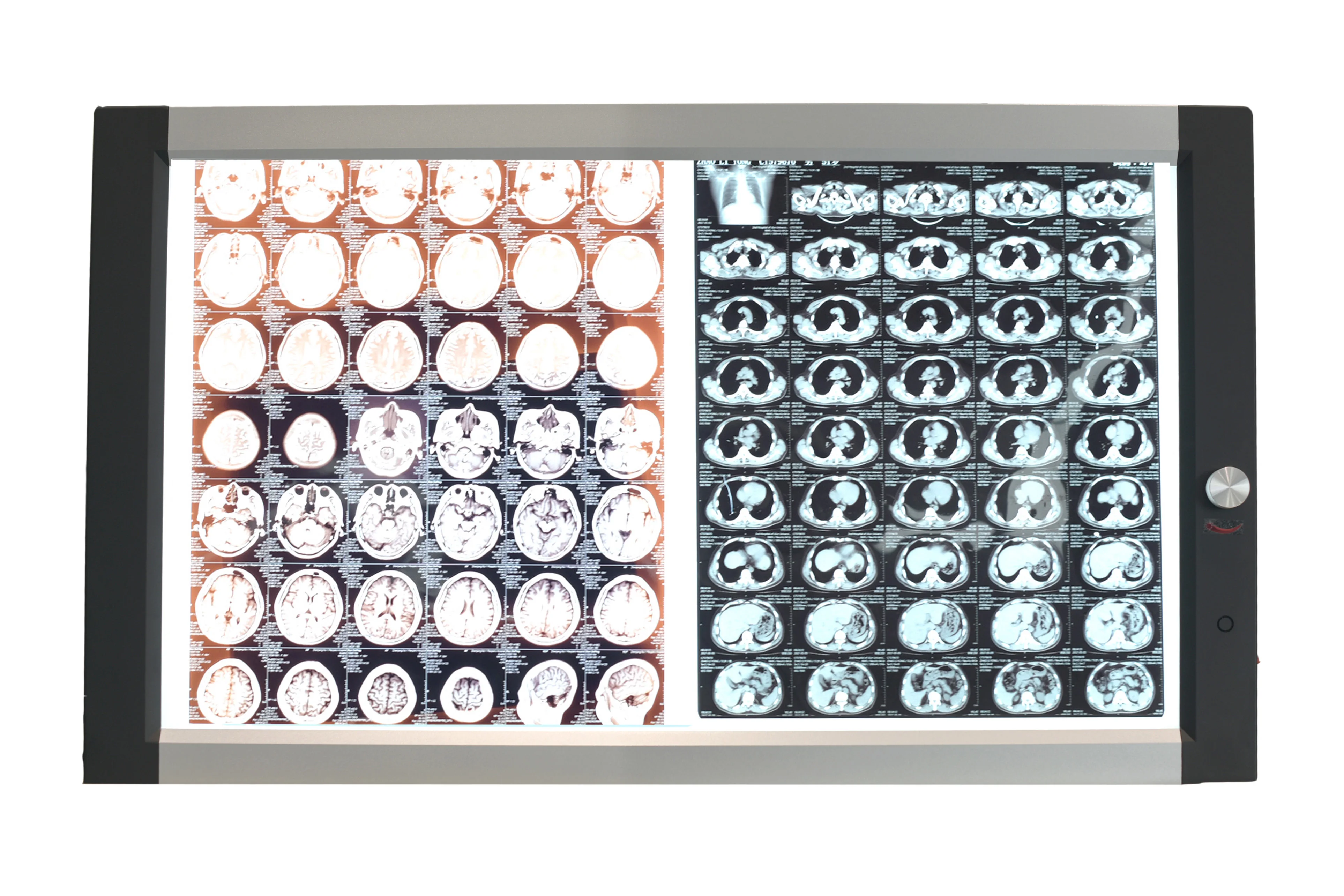 Micare DQ-2B 60w led double viewer  Hospital special orthopedic heart center X-ray source examination lamp