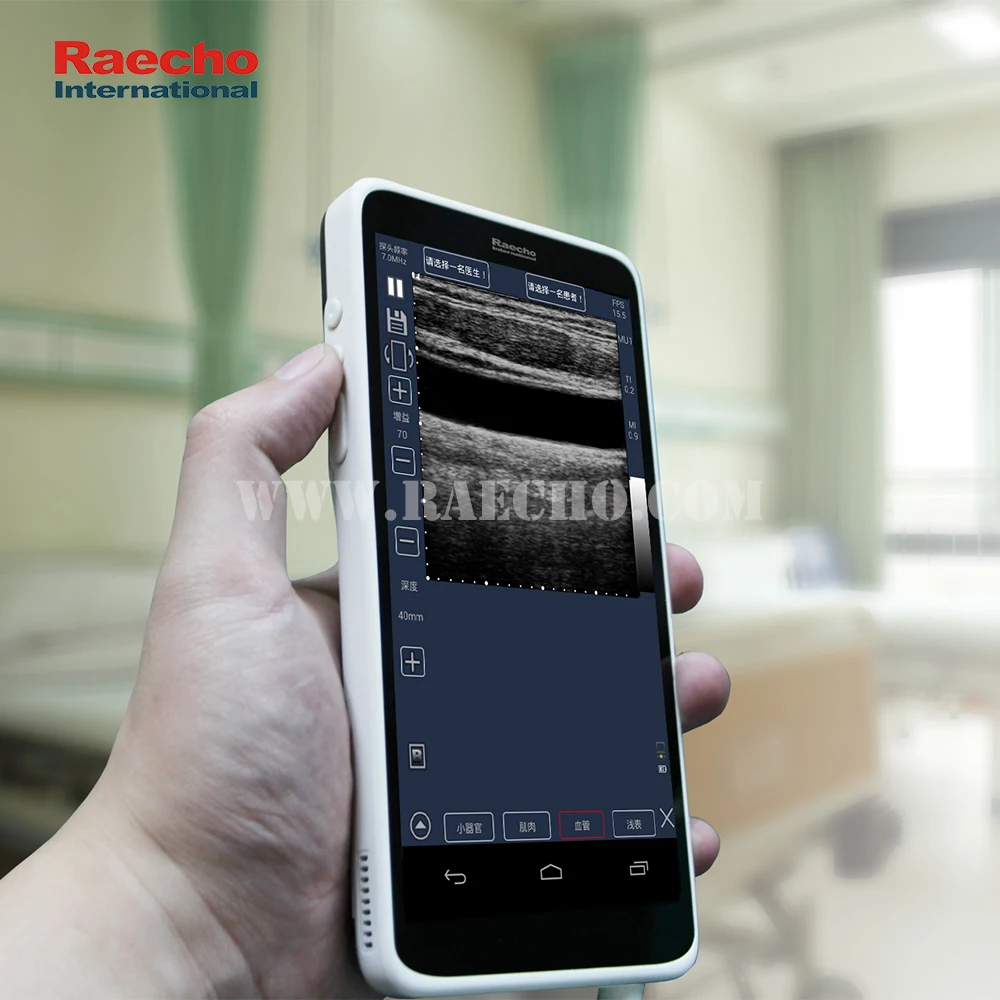  RMU-3 Wi-Fi подключение Мини Портативный ультразвуковой датчик беспроводной