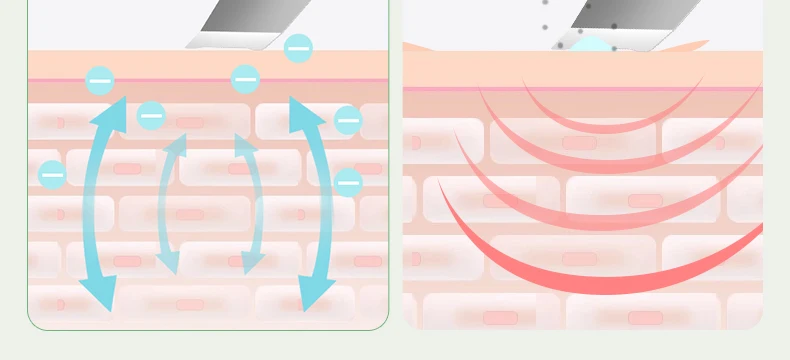 Deep Pore Head head Cleanser Exfoliating Spatula Personal Care Ems Vibrating Face Skin Scrubber Device