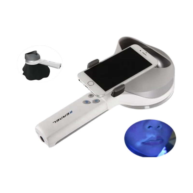 Portable Kernel Woods Lamp Skin Analysis Medical Dermatoscope for Inspection of Vitiligo Psoriasis Eczema