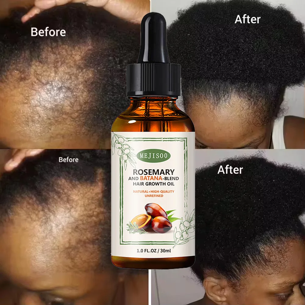 Private Label 100% Natural Organic Rosemary Castor Almond Oil Men Women Scalp Care Serum Hair Treatment Growth Batana Oil