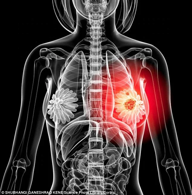 Mammography film/ medicalx ray film / MNedical consumbable