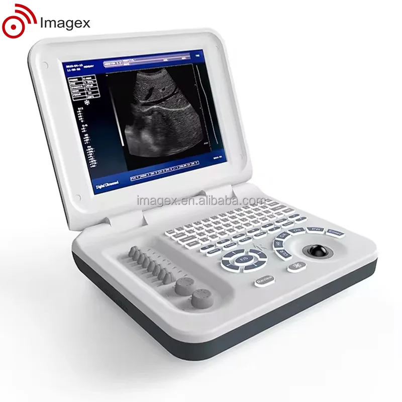 Портативный ультразвуковой аппарат с многочастотными зондами для акушерства и гинекологии