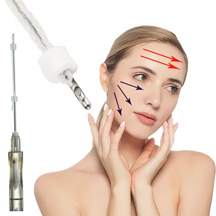 New Product Mesh Pcl Thread L Blunt 19g 38mm Best Face Lifting Thread Mesh Pack Pcl Cog Thread Lift