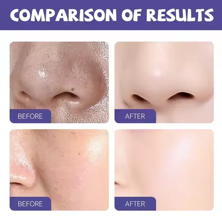 LIFITT Private Label Blueberry Black Head Remover Anti-Aging Moisturizing Clay Mask for Face Whitening Acne Treatment Use Body