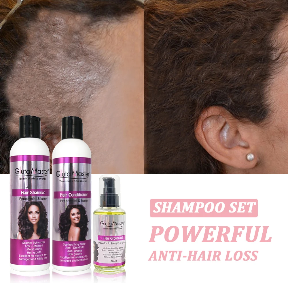 Organic Natural Anti Hair Loss Shampoo Growth Hair Products Private Label