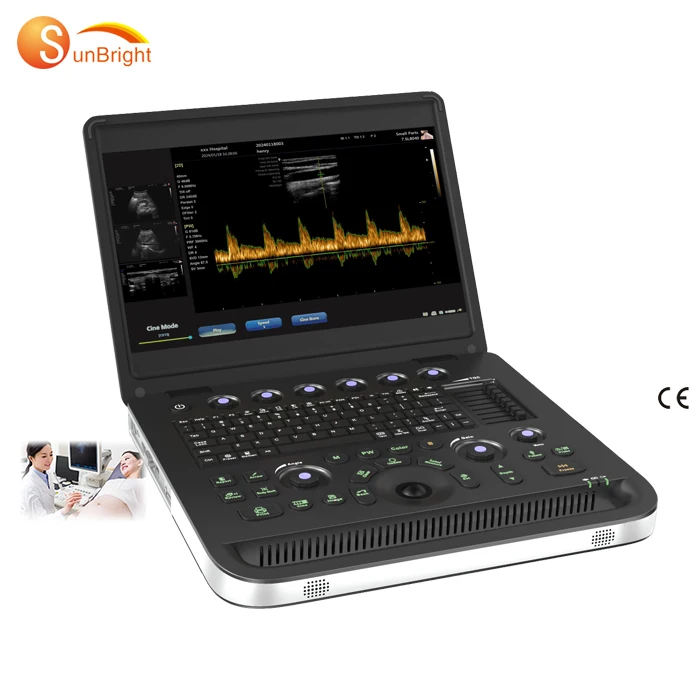 SUN-800C 15.6 inches digital windows system ultrasound ecografo portatil doppler