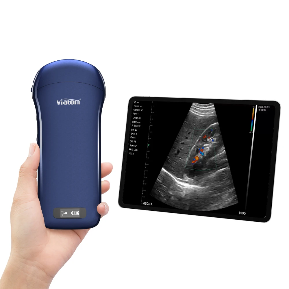 Viatom Handheld Ultrasound Probe 5 Display Mode One-Probe Multipurpose Wireless Portable Ultrasound Scanner