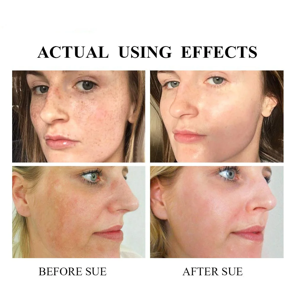 Amazon Popular Organic Skin Care Anti Aging Whitening Day Cream  for face