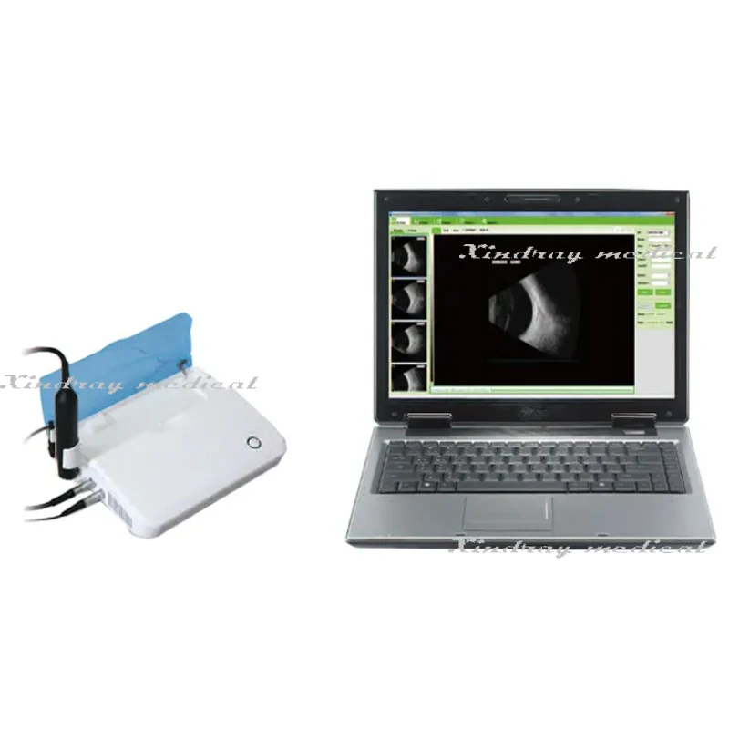 Sp-2000 Ophthalmology Ocular Test Device Ophthalmic Ultrasound Ab a B Scan for Eye Diagnosis