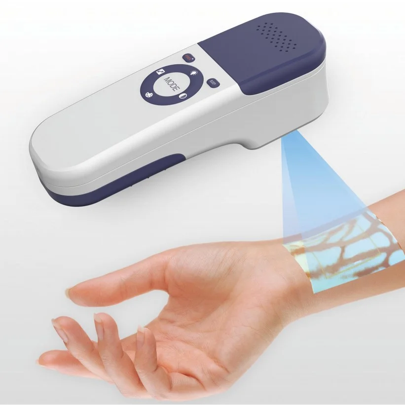 Hot-selling Medical Equipment Visual Display Body Facial Vein Finder Hospital Device For Hospital Use