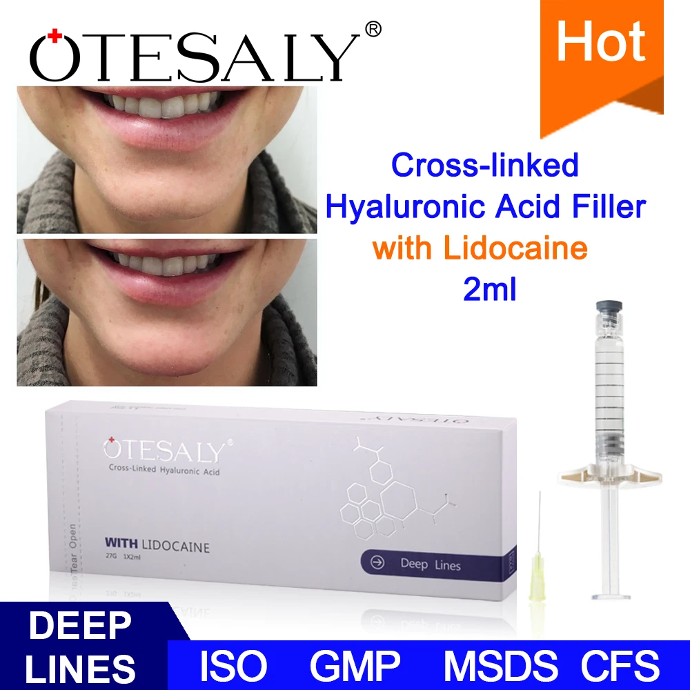 
Best Results Cross-linked 1ml 2ml Hyaluronic Acid Gel Injectable Filler with 0.3% Lido for Women to Remove Wrinkle 