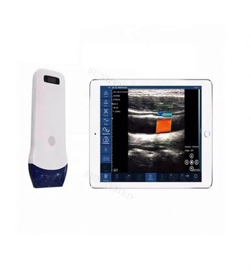 SY-5L Line array wireless probe ultrasound machine hospital medical device color doppler linear probe ultrasound