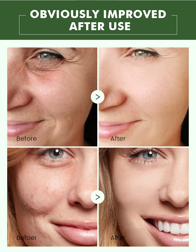 Best Selling Beauty Store Exclusive Skin Care Essence Anti-Aging Whitening Retinol Facial Essence
