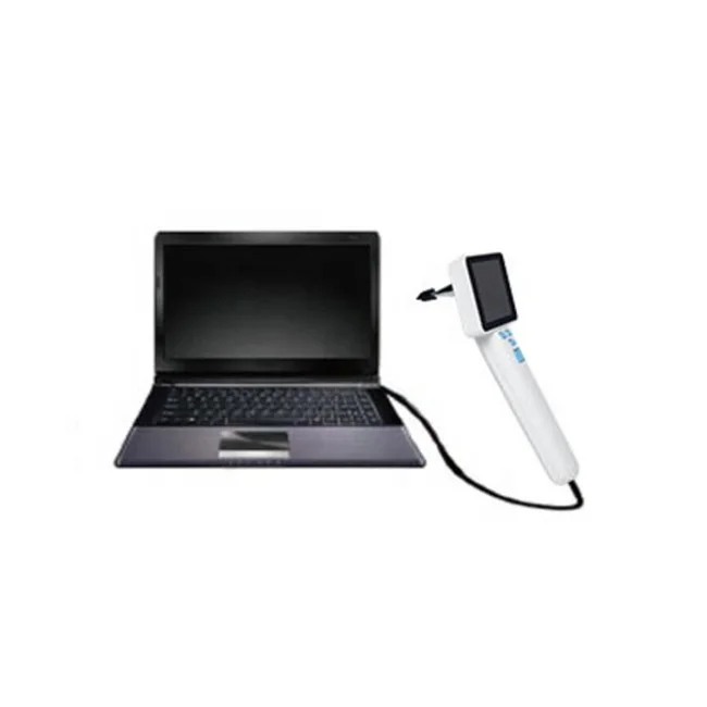 3 Inch LCD Screen Digital Video Otoscope ENT Camera for Ear With Rechargeable Lithium Battery 3.7V 2600mA