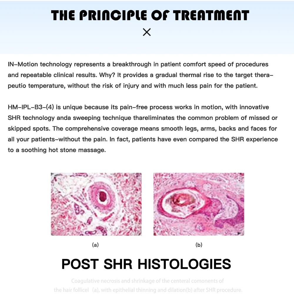 Weifang Huamei Portable IPL filters ipl hair removal ice cooling professional ipl machine