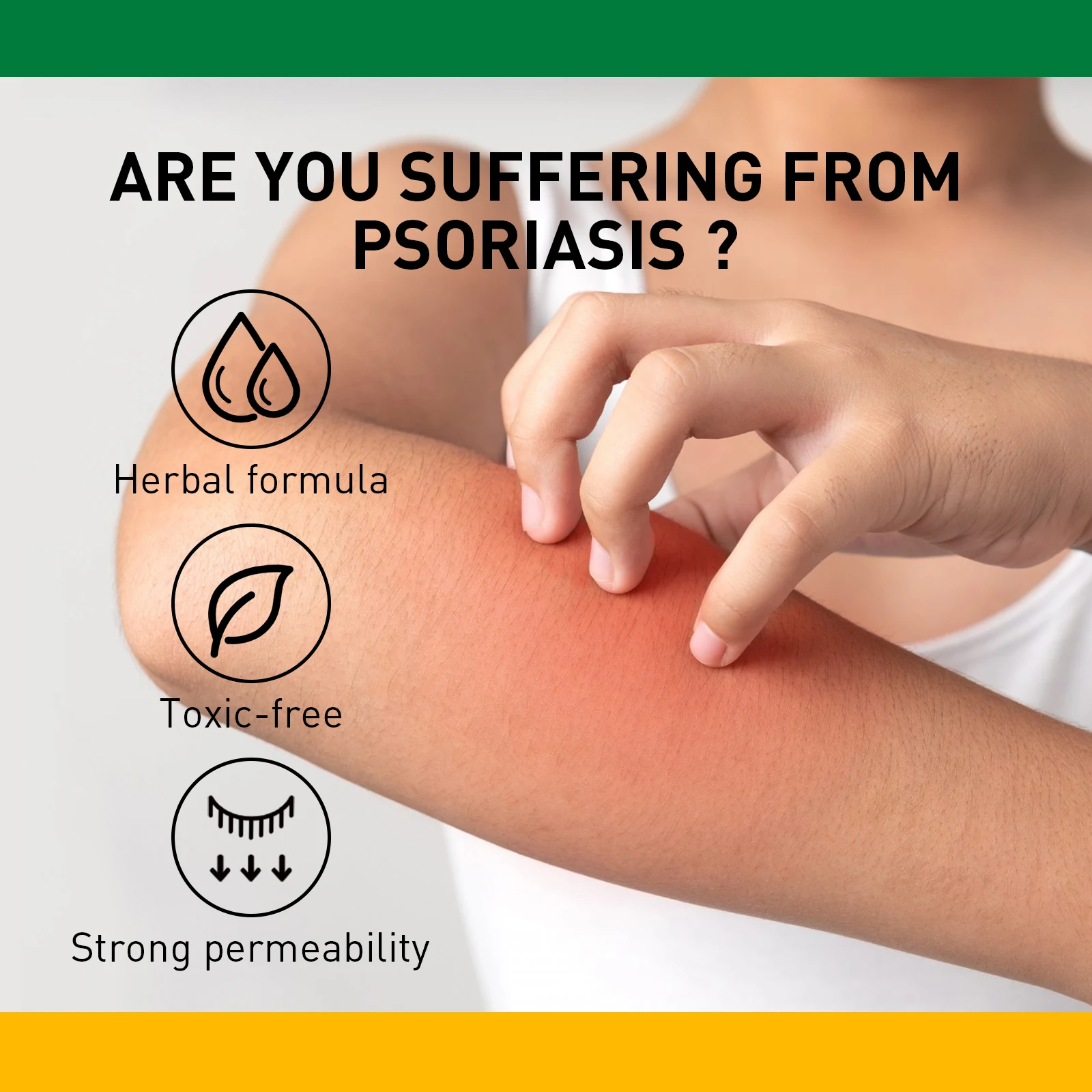 Custom logo Herbal Bacteriostatic Cream Psoriasis Dermatitis Ointment Anti-itching Skin Problems Antifungal Cream