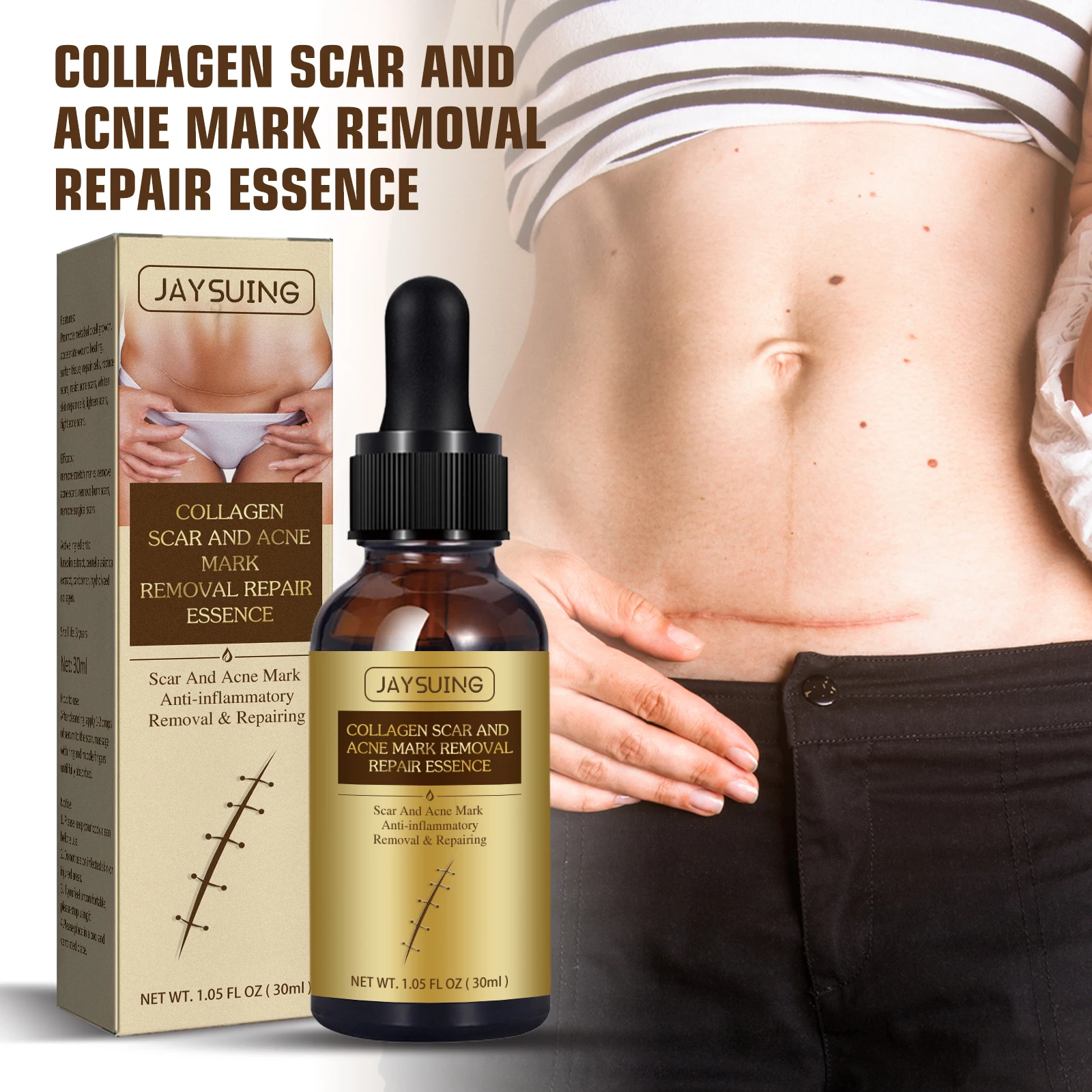 Hot Selling Natural organic fade Caesarean scar surgery scar to burn marks repair and smooth skin scar essential oil