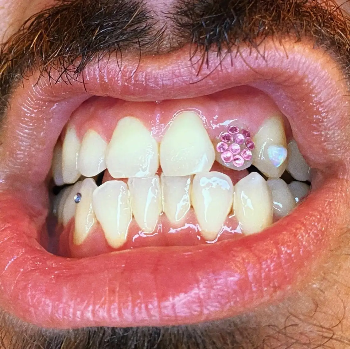 Wholesale Dental Butterfly Teeth Gems Horse Eye Round Shape Blue Green Opal Tooth Gems