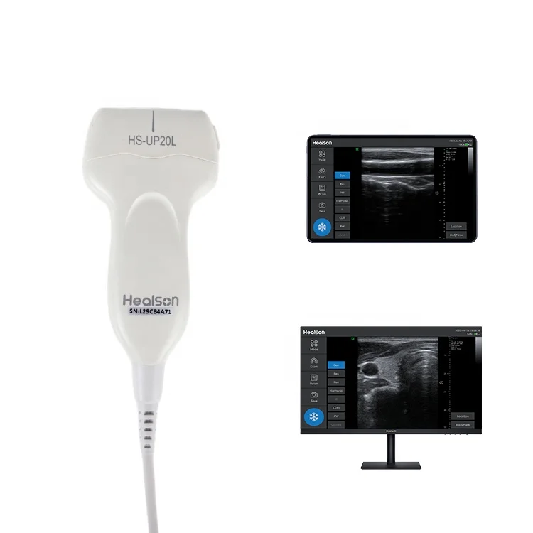 Healson Pocket Linear Doppler Handheld Digital Ultrasound Probe Portable USG Machine