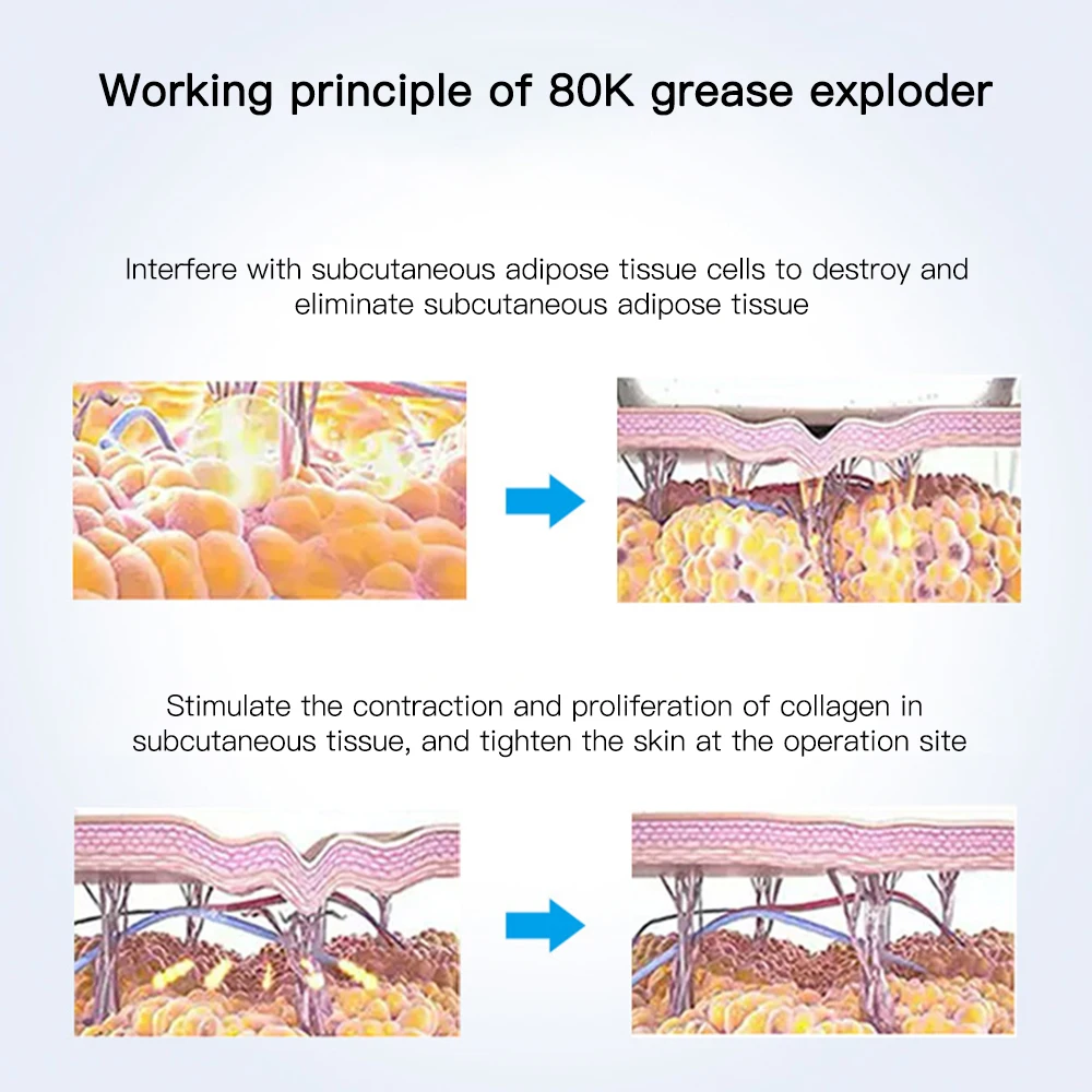 6 in 1 80K cavitati0n Home Use Beauty Equipment Multi Functional ultras0nic Machine with EMS pad