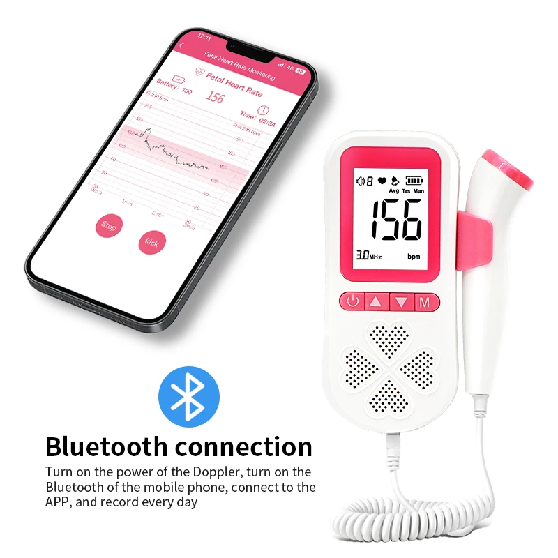 Remote Telehealth Record and Share Baby Heartbeat Monitor Fetal Doppler with App Mobile Phone Bluetooth Connect