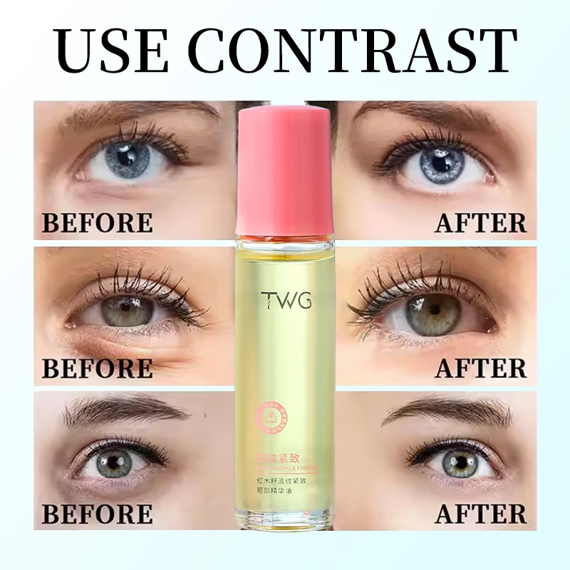 TWG Private Label Eye Oil Anti Wrinkle Serum Anti Aging Products Skin Care Essential Oil Eyes Care Massage Eye Serum