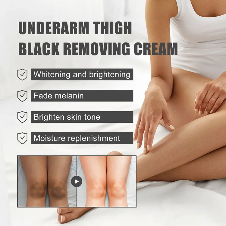Good price of New product body cream whitening underarm whitening cream bleaching cream black skin whitening set