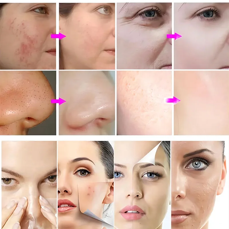 3 In 1 Co2 Bubble Beauty Facial Spa Machine Skin Tightening oxgen facial machine