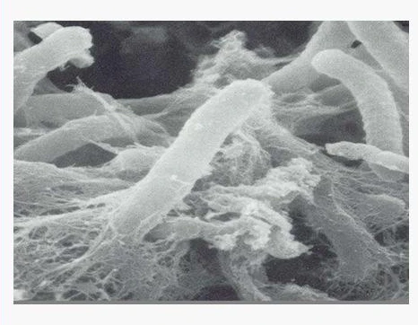 best aerobic bacteria specially for the treatment of industrial wastewater