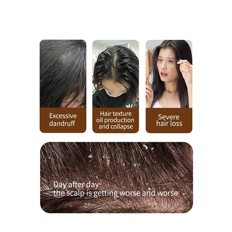 Moisturizing hair care refreshing scalp and oil control chinese shampoo hair products shea moisture shampoo coconut oil