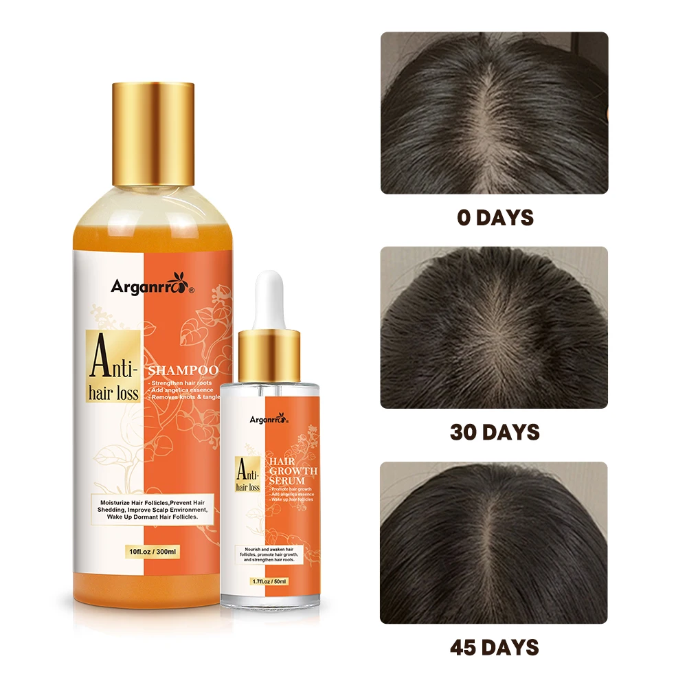 Independent development Hair Care Set Regrowth Anti LOSS Shampoo And Hair Growth Serum Angelica Sinensis Angelica Sinensis