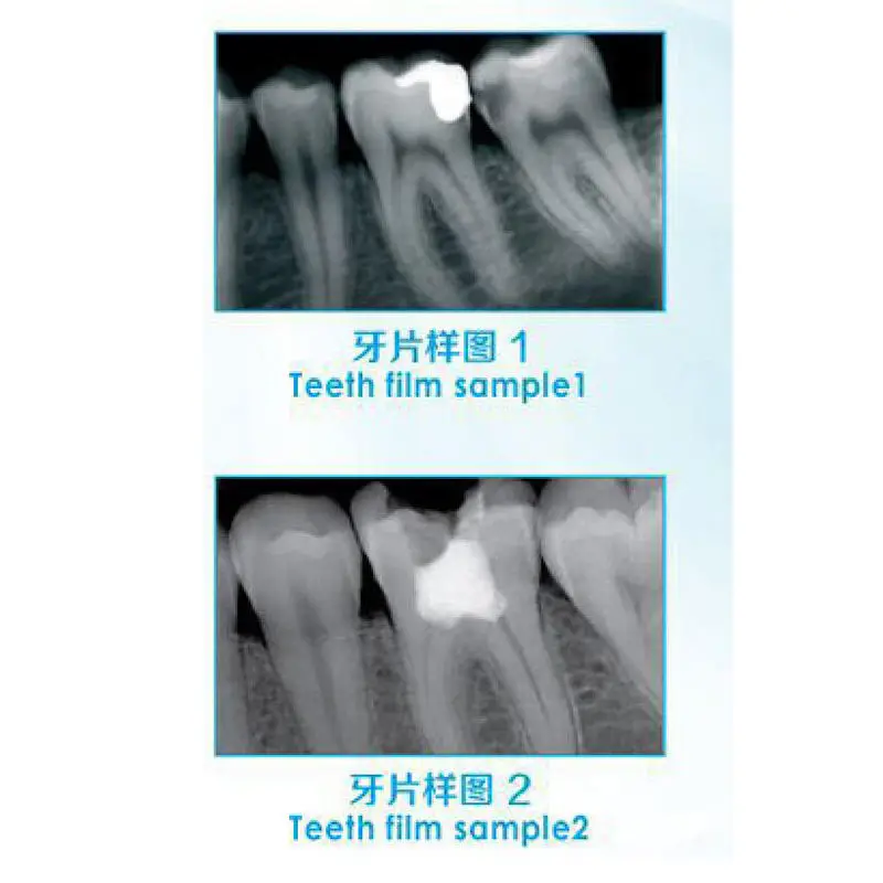 Cheap Price panoramic dental x ray machine portable dental x ray machine x ray machine dental