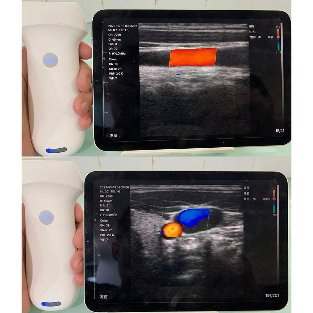 Handheld Portable Ultrasound Equipment for Veterinary Use Equine and Pig Ultrasound for Pregnancy Diagnosis
