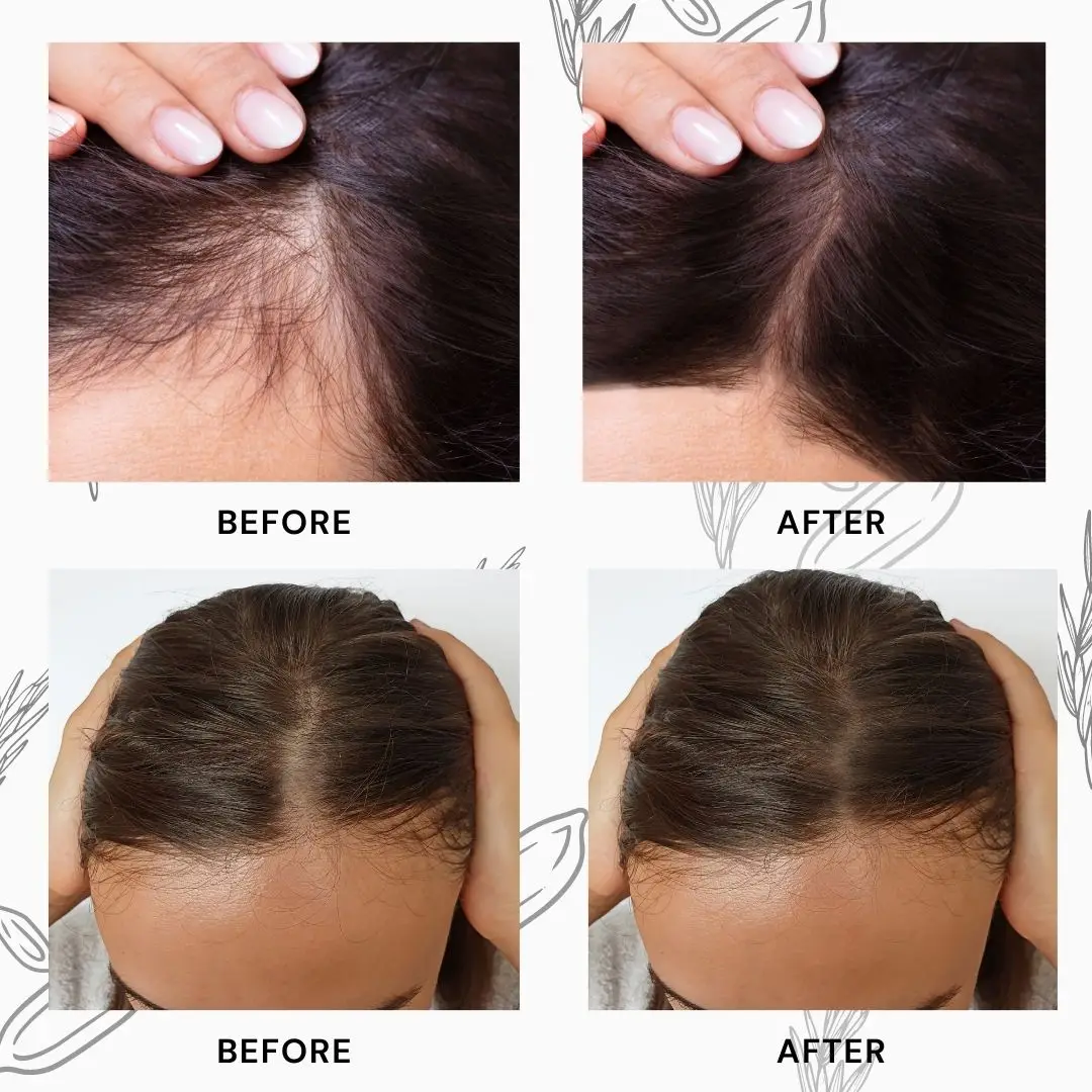 Organic Rosemary Water Rice Water Organic Hair Care Private Label for Hair Growth Safe for Keratin and Color Treated Hair