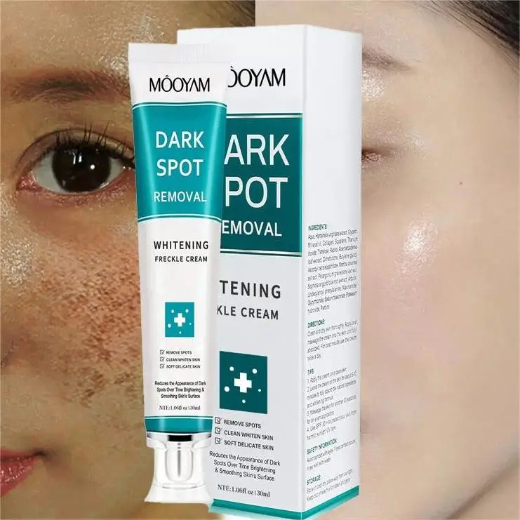 Hot Sale OEM Dark Spot Removal Cream Moisturizeing Brightens the Complexion 30g MOOYAM Whitening Dark Spot Removal Cream