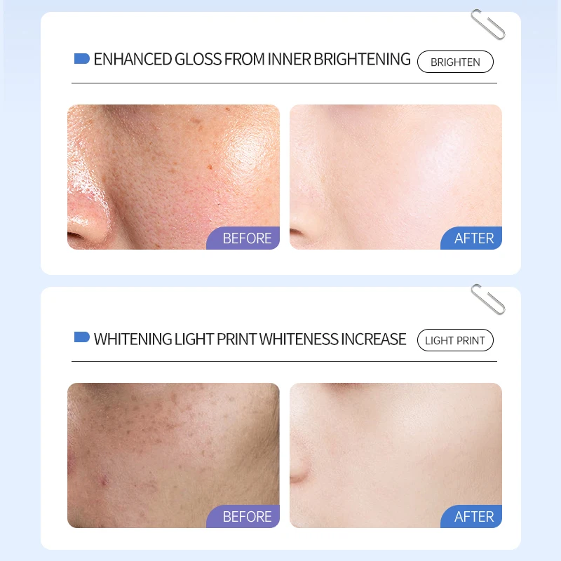 Private Label OEM Manufacturer Rosemary Shrinking Ordinary Whitening Anti Aging Niacinamide Skin Care Face Serum Organic