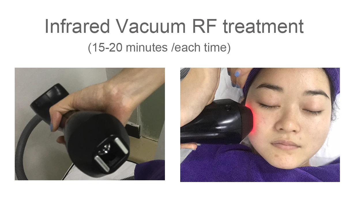 Hot Sale 2 in 1 Infrared rf 80k Body Massage Vacuum Roller Slimming machine