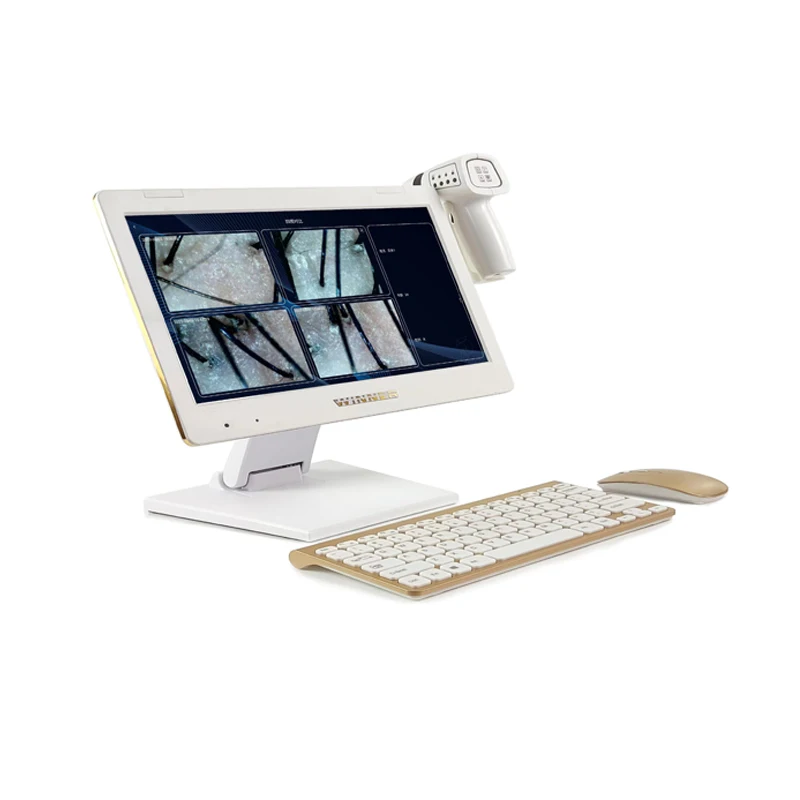 Wholesale of hair follicles and scalp scanning detectors by manufacturers Hair analyzer